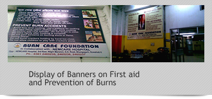Display of Banners on First aid and Prevention of Burns